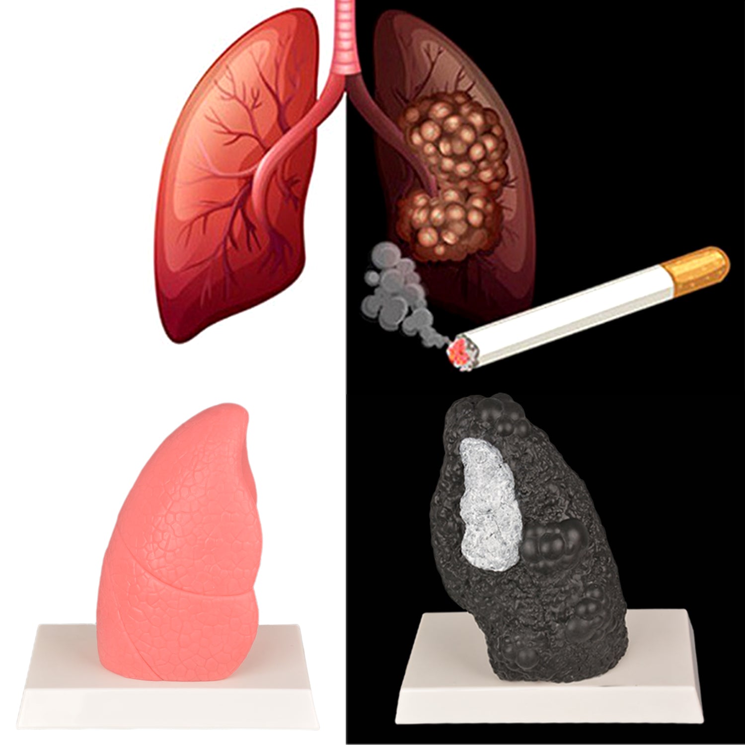 Realistic Lung Anatomy Educational Model