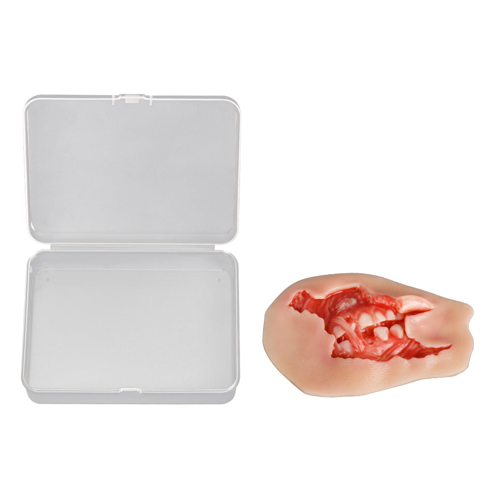 Wound Moulage – Maxillofacial Burn Wound Simulation Model