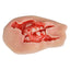 Wound Moulage – Maxillofacial Burn Wound Simulation Model