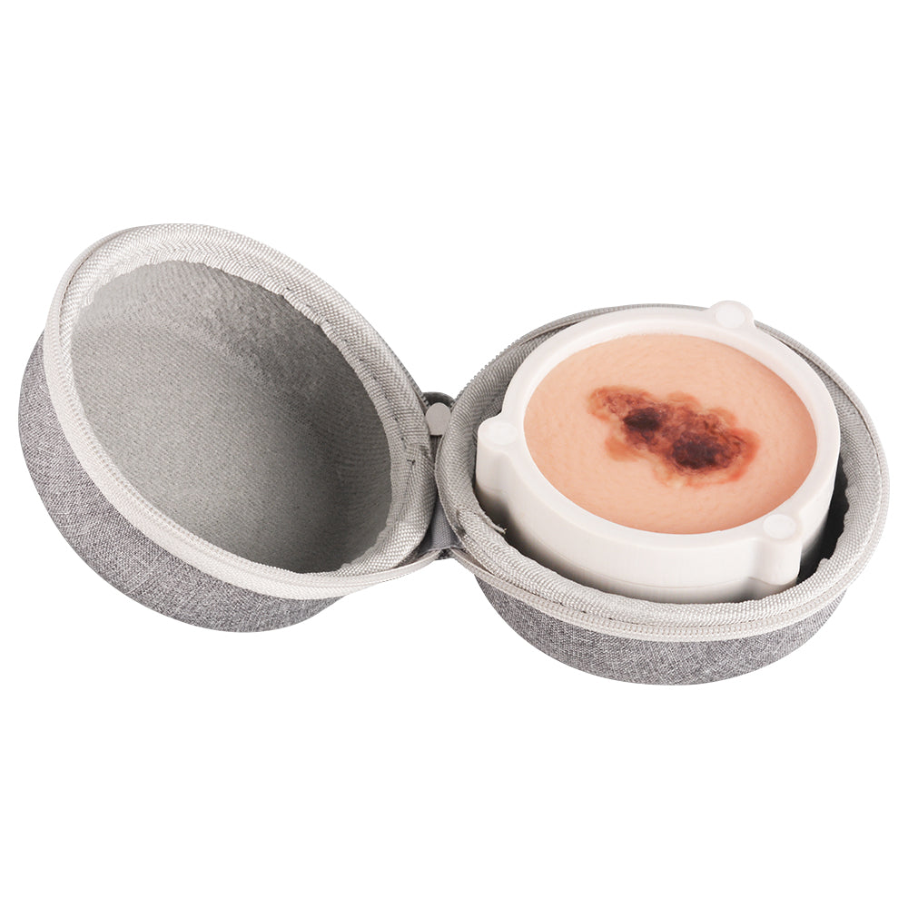 Human Skin Cancer Model for Dermatology Teaching & Training