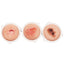 Human Skin Cancer Model for Dermatology Teaching & Training