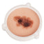 Human Skin Cancer Model for Dermatology Teaching & Training
