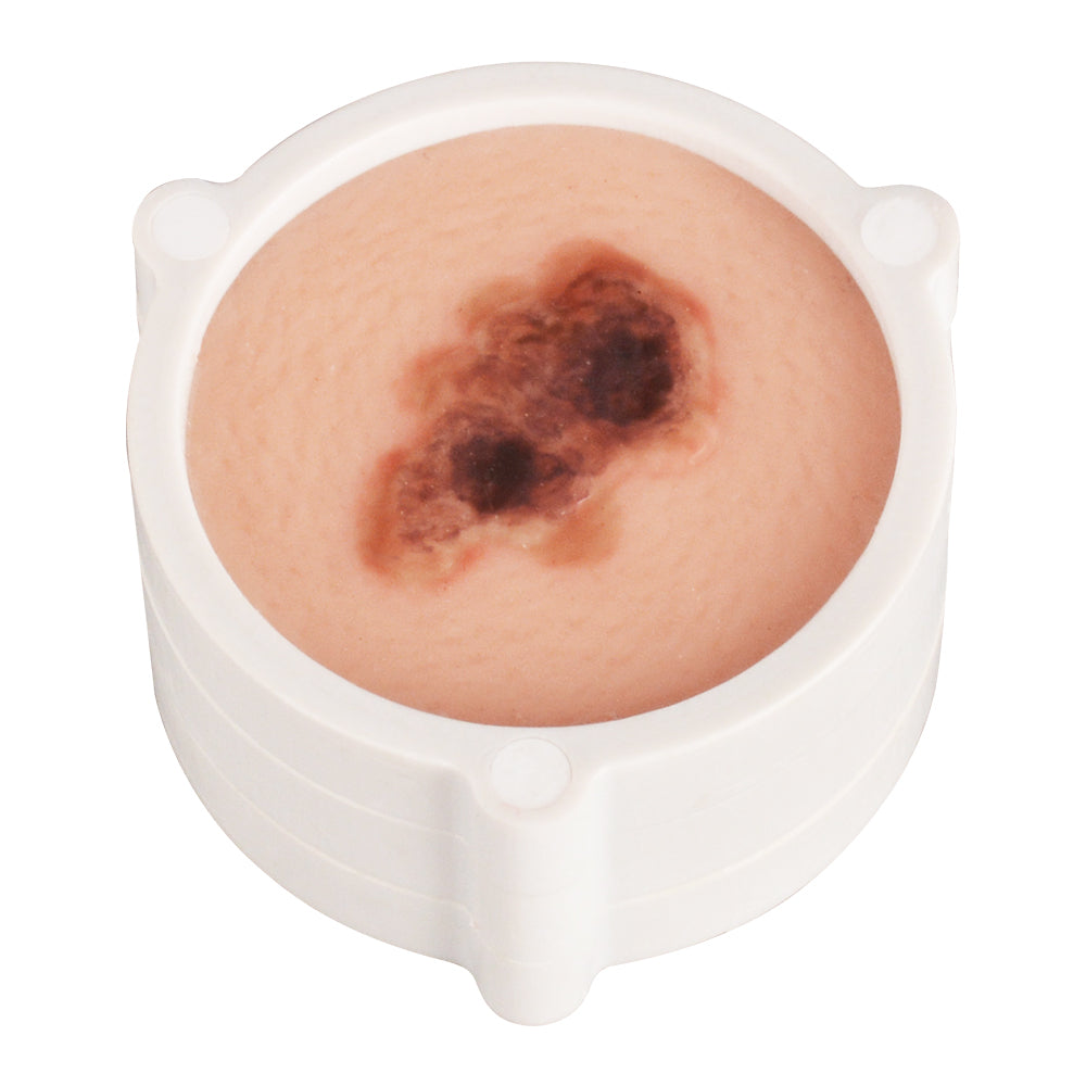 Human Skin Cancer Model for Dermatology Teaching & Training
