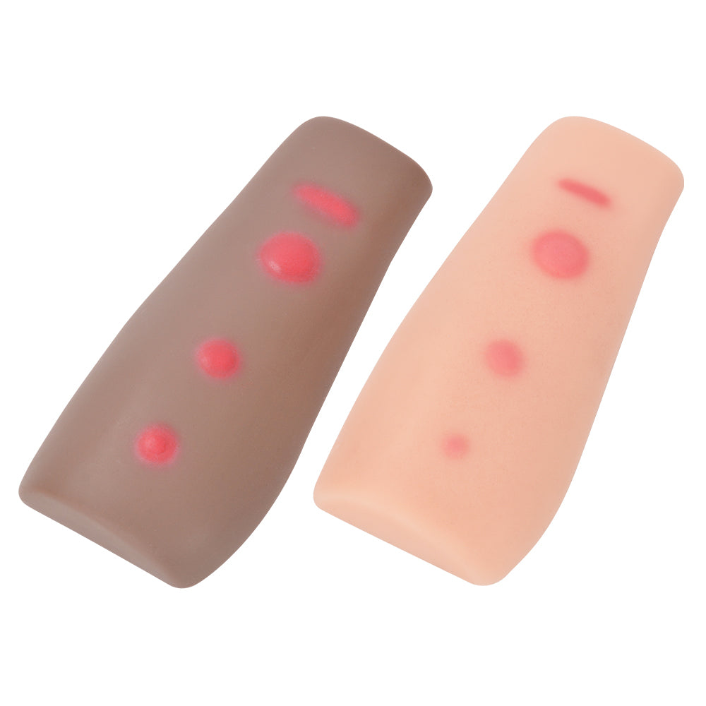 Palpable Tuberculosis TB Test Training Model Set