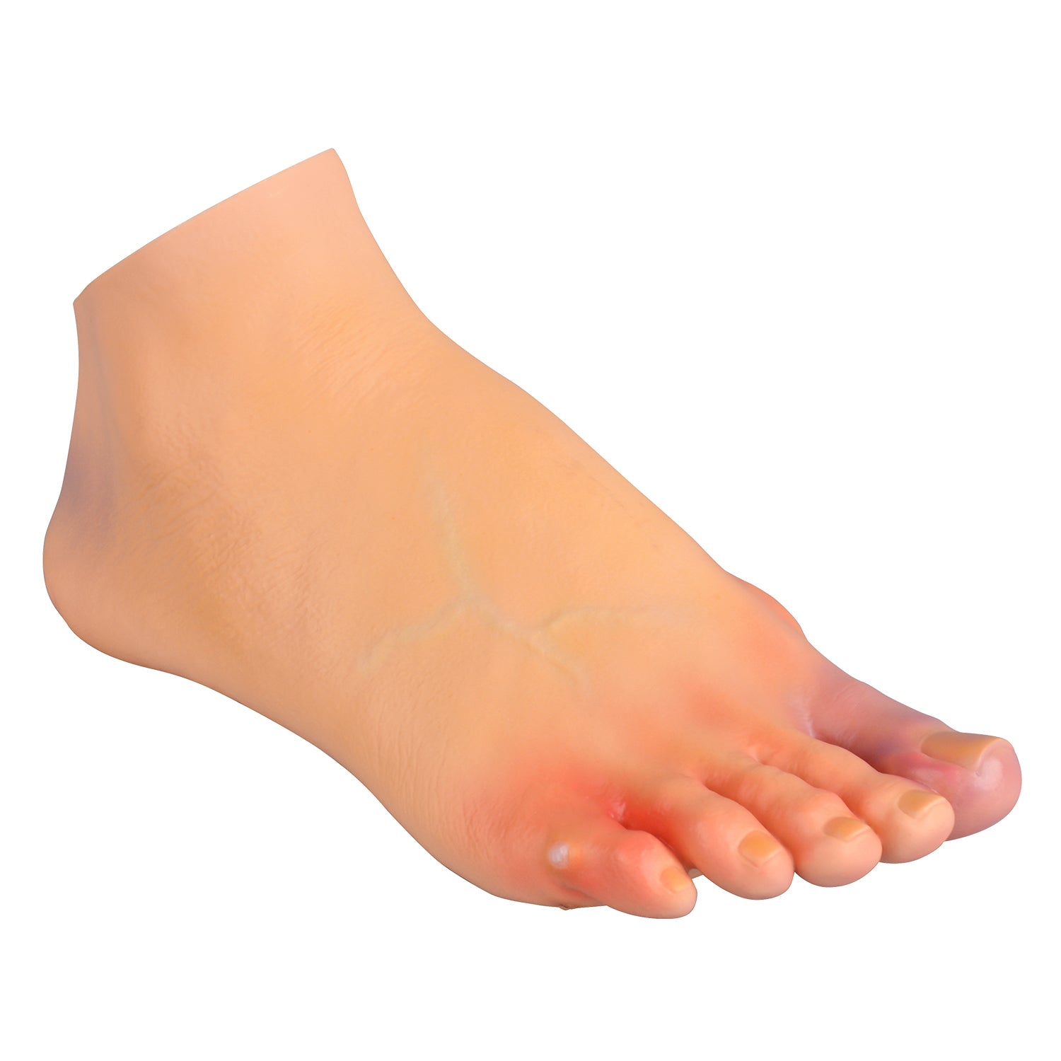 Foot Pathology Model with Common Foot Disorders