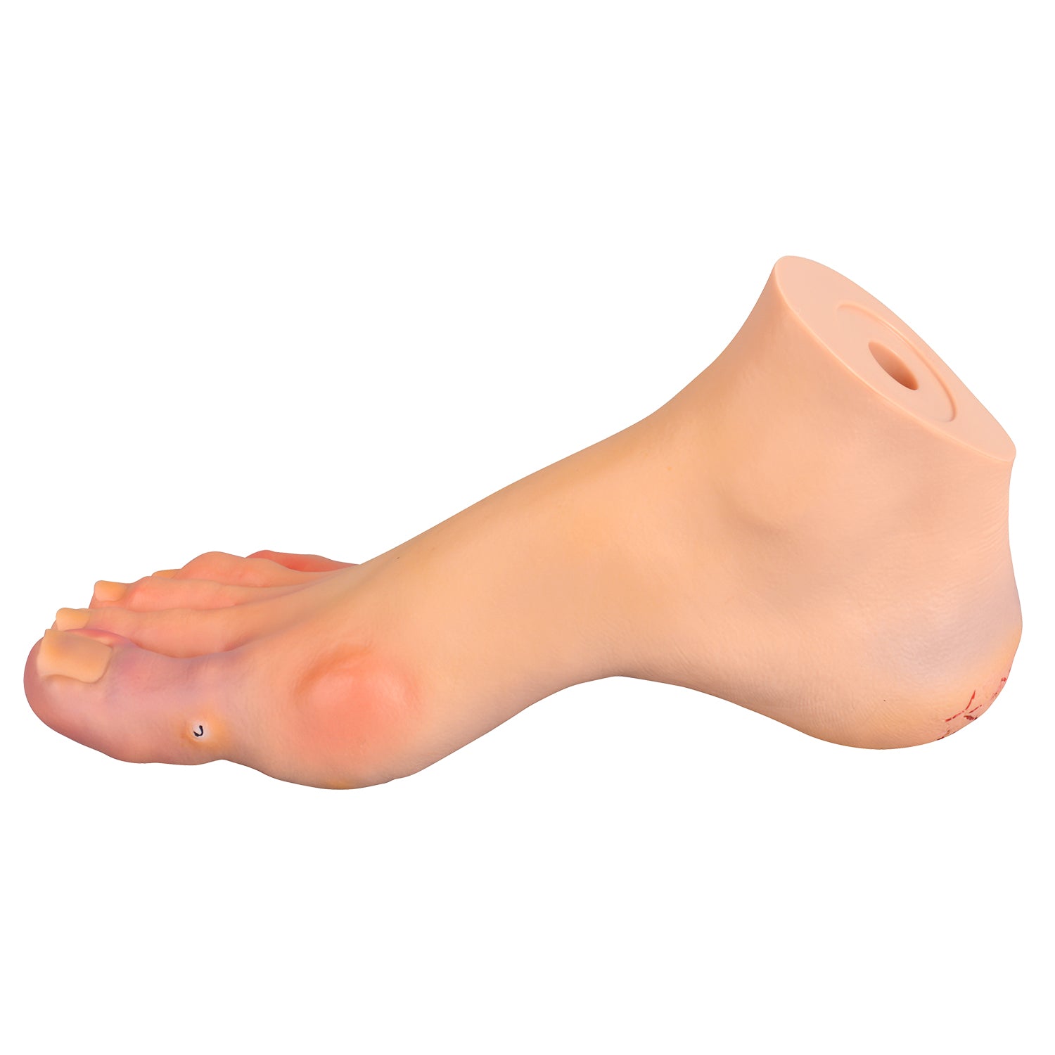Foot Pathology Model with Common Foot Disorders