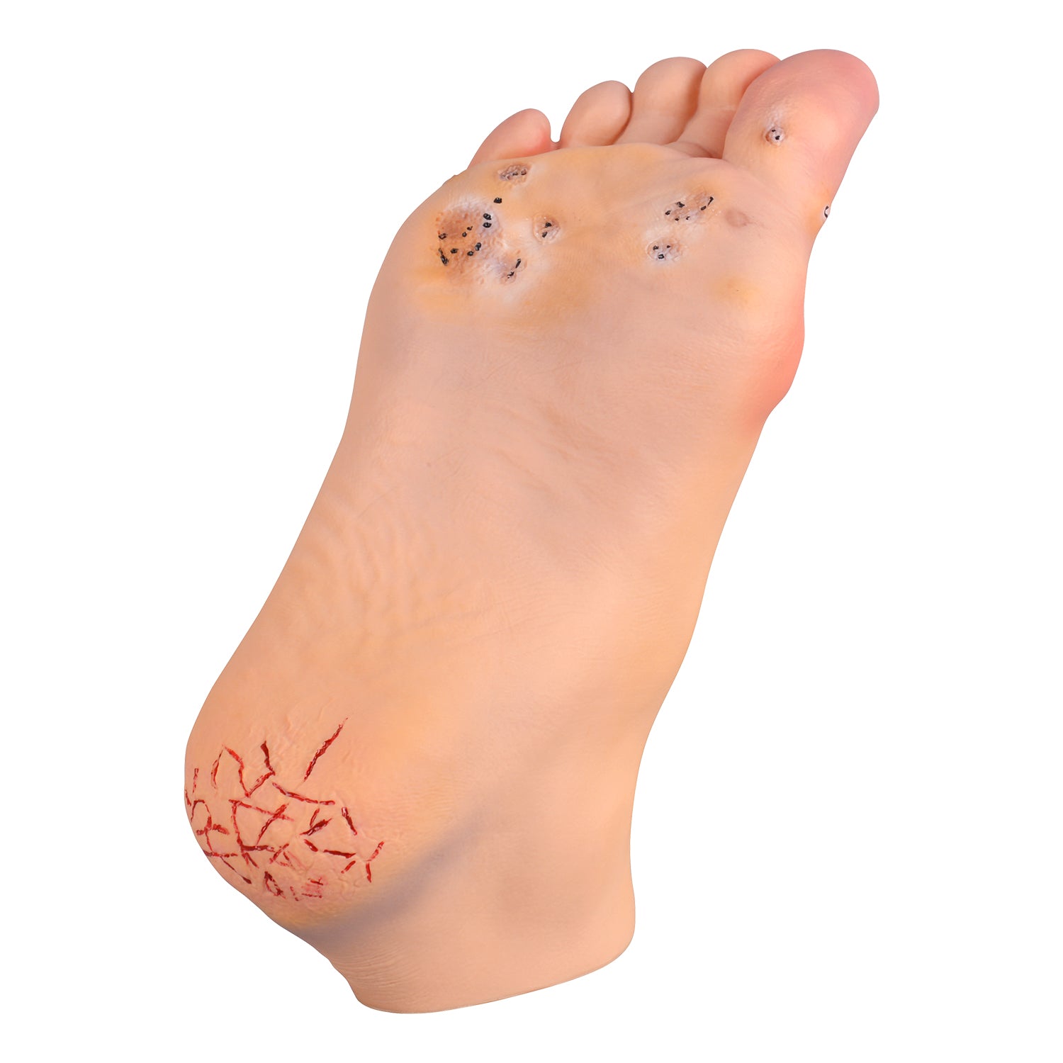 Foot Pathology Model with Common Foot Disorders