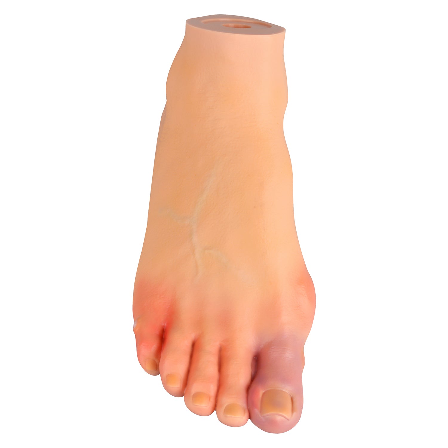 Foot Pathology Model with Common Foot Disorders