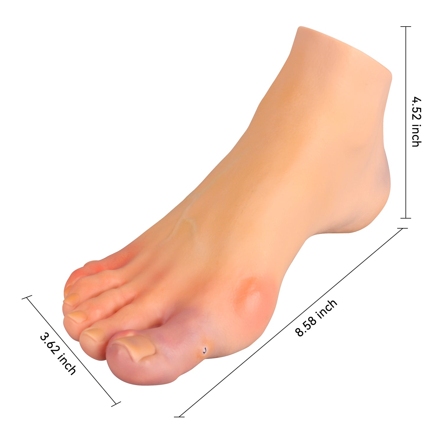 Foot Pathology Model with Common Foot Disorders