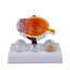Cataract Eye Model