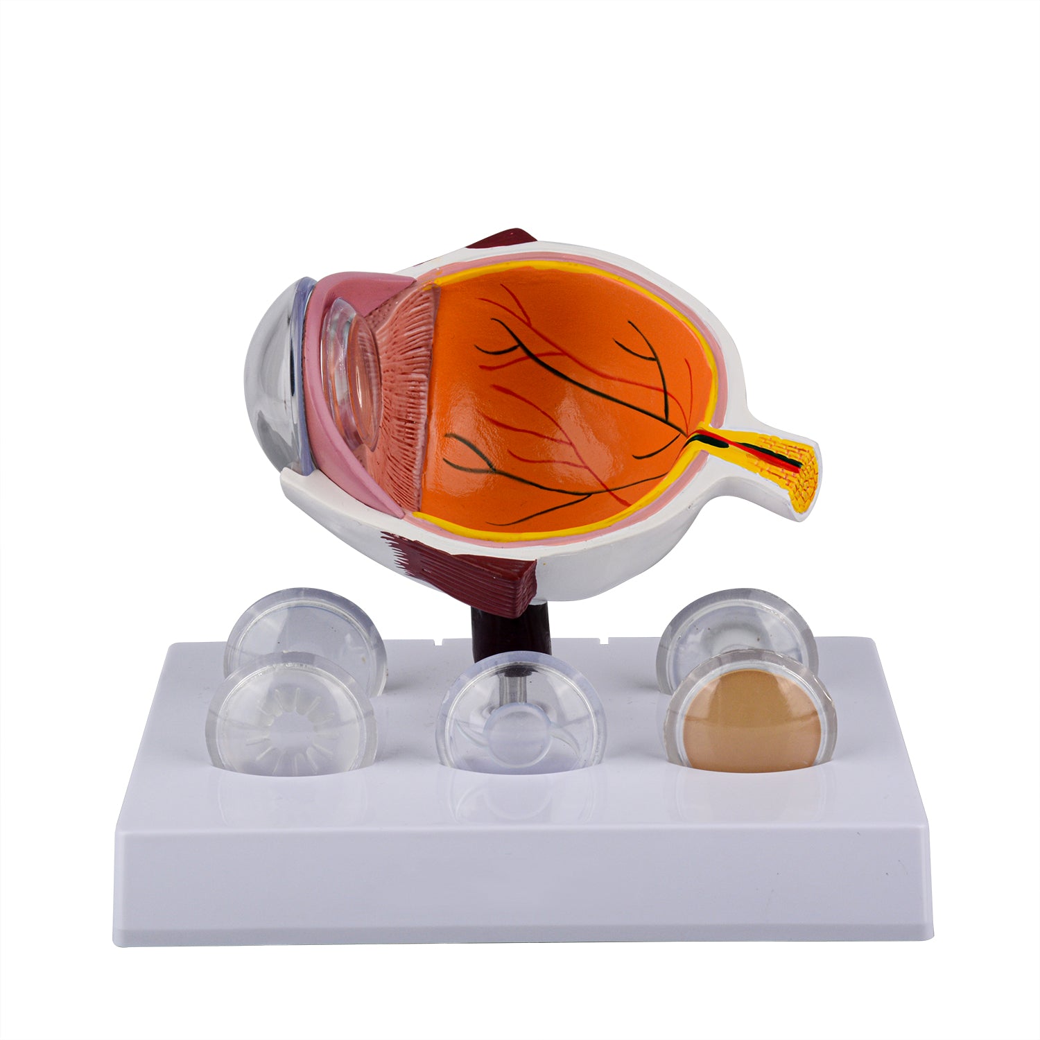 Cataract Eye Model