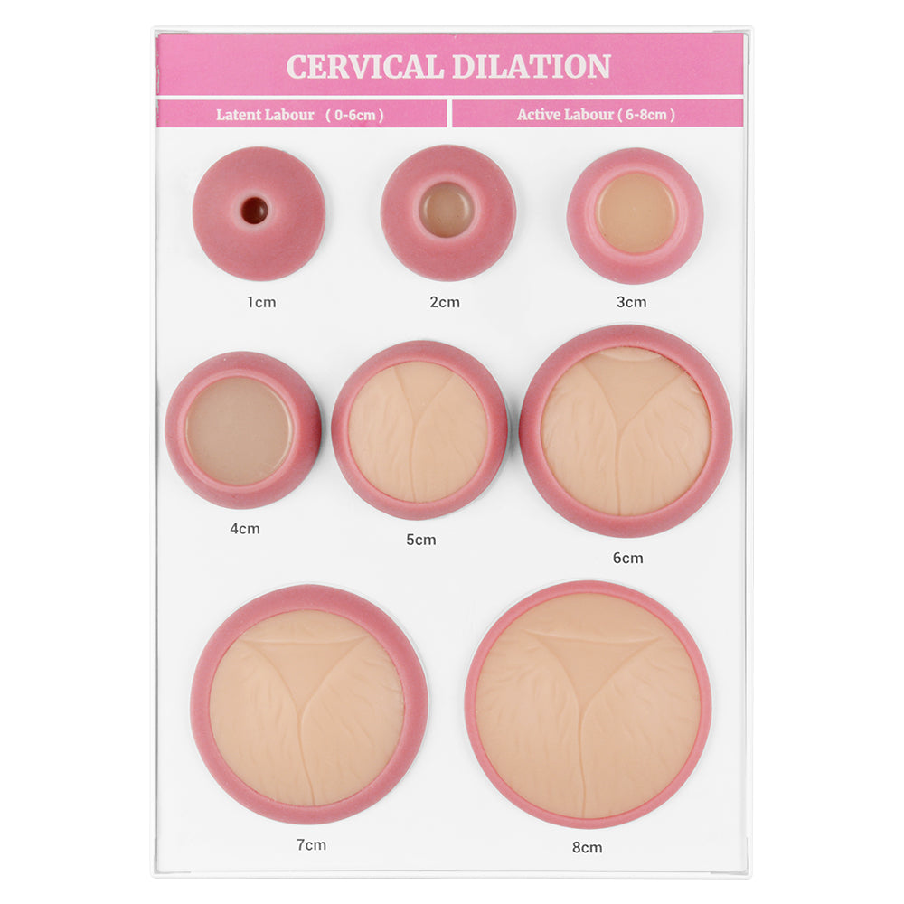 Cervical Dilation Display Board For Childbirth Training