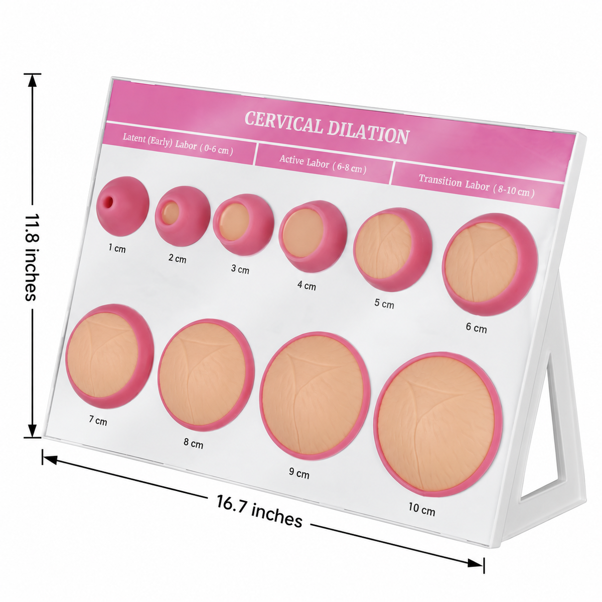 Cervical Dilation Model (1-10 cm)