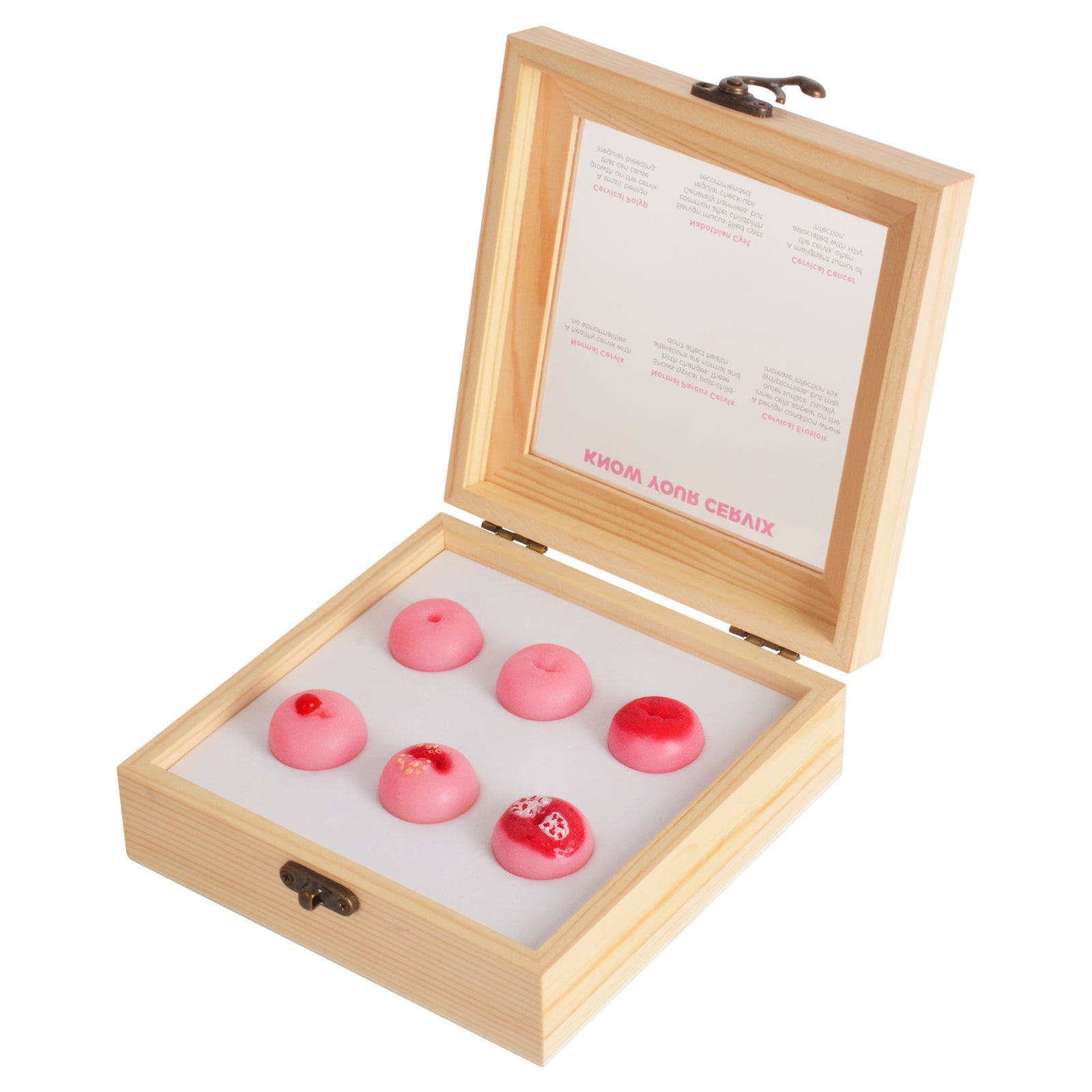 Cervix Model for Patient Education