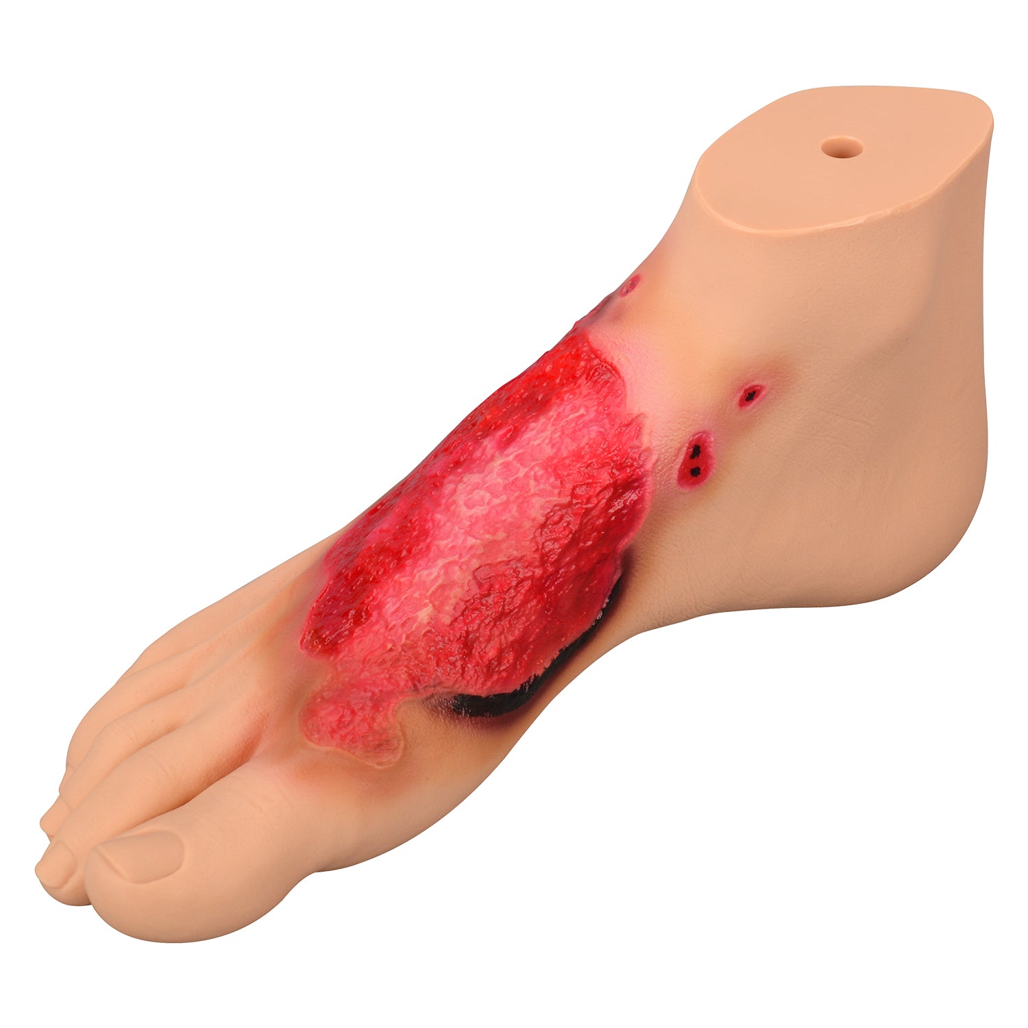 Chemical Burn Foot Injury Simulation Model