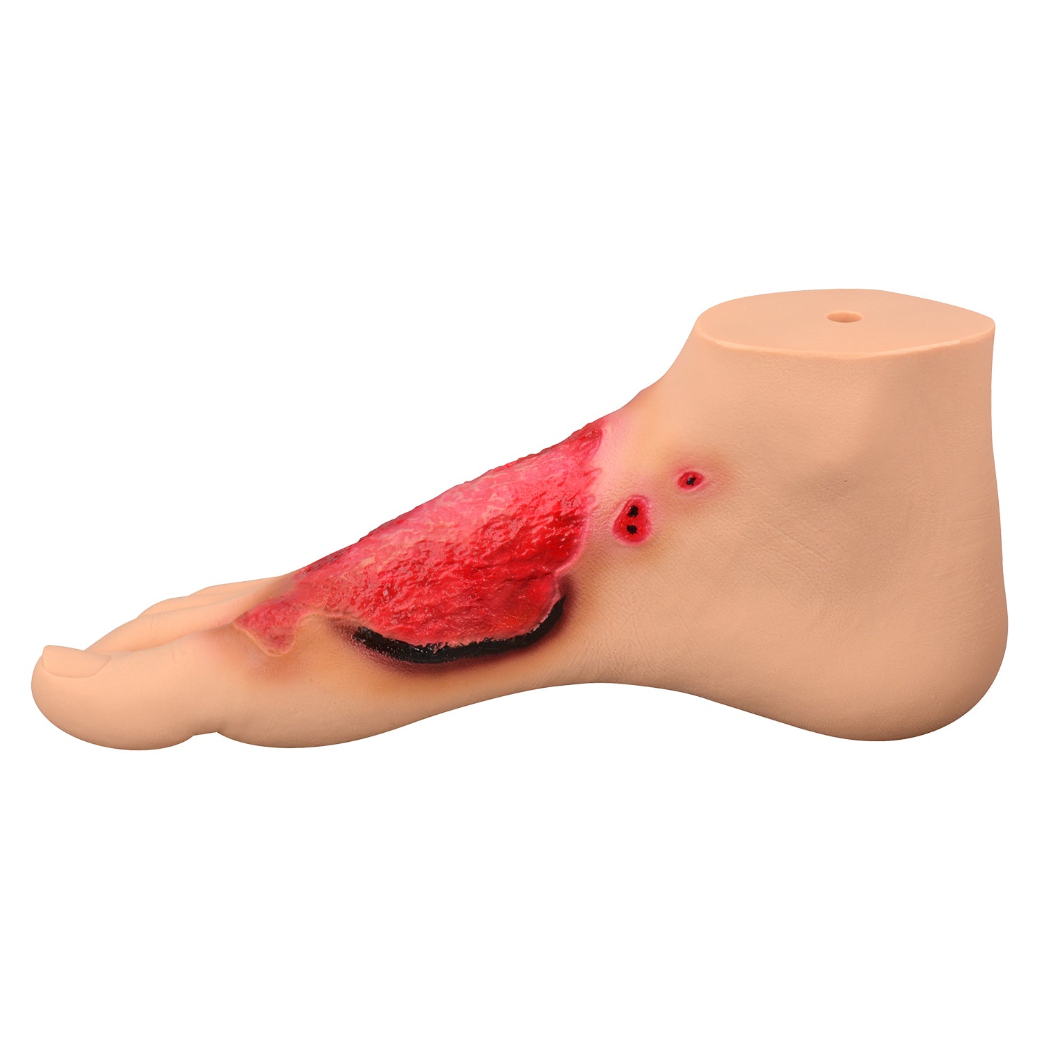 Chemical Burn Foot Injury Simulation Model