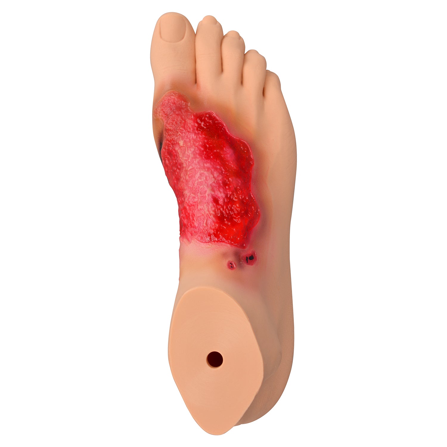 Chemical Burn Foot Injury Simulation Model