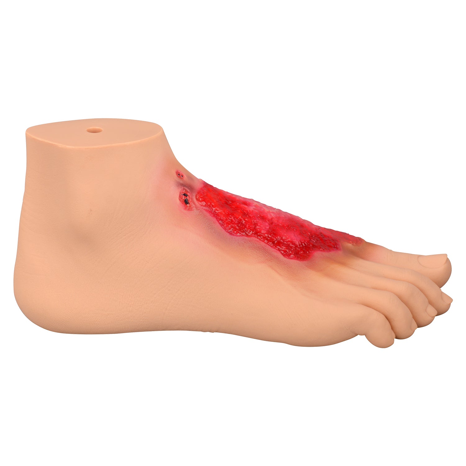 Chemical Burn Foot Injury Simulation Model