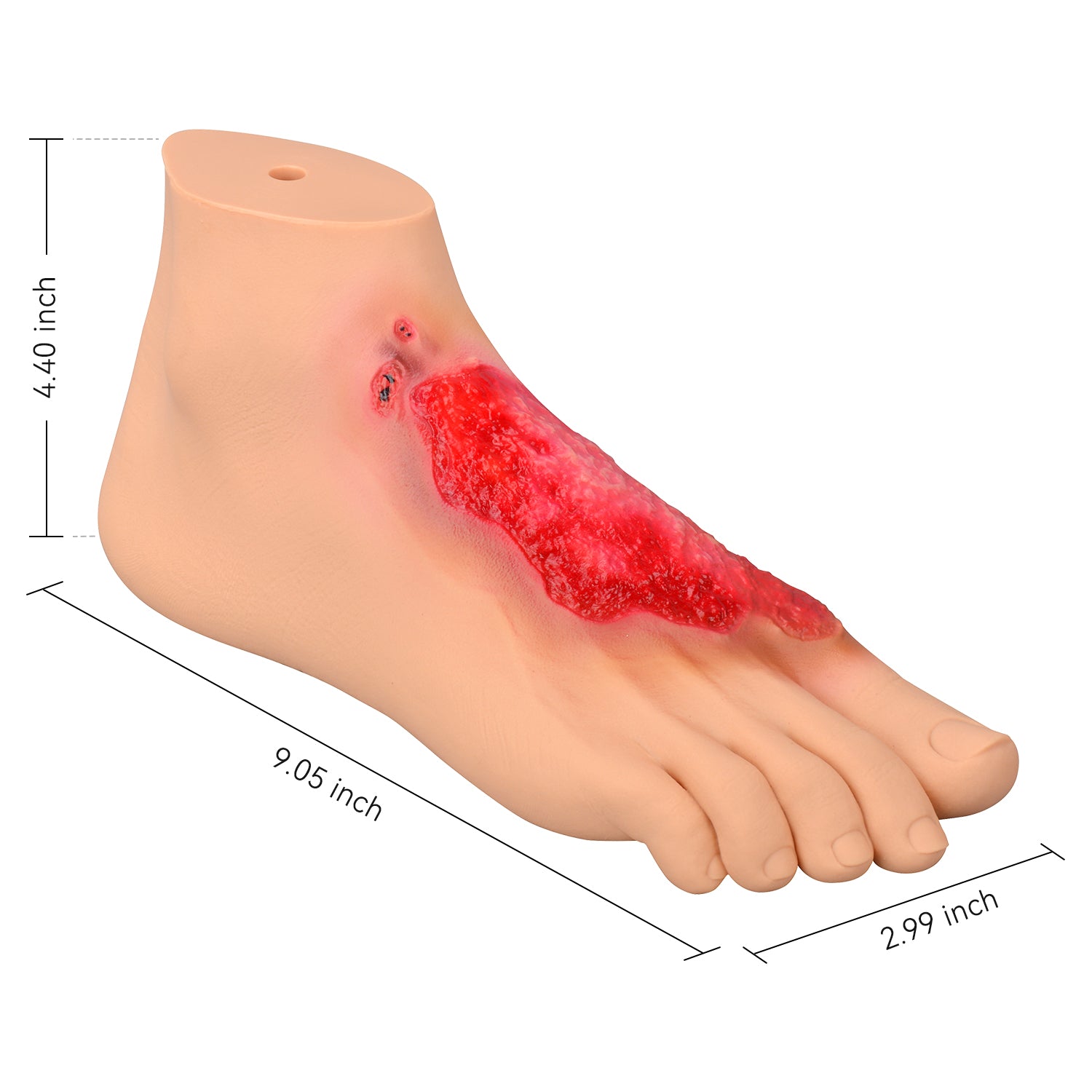 Chemical Burn Foot Injury Simulation Model