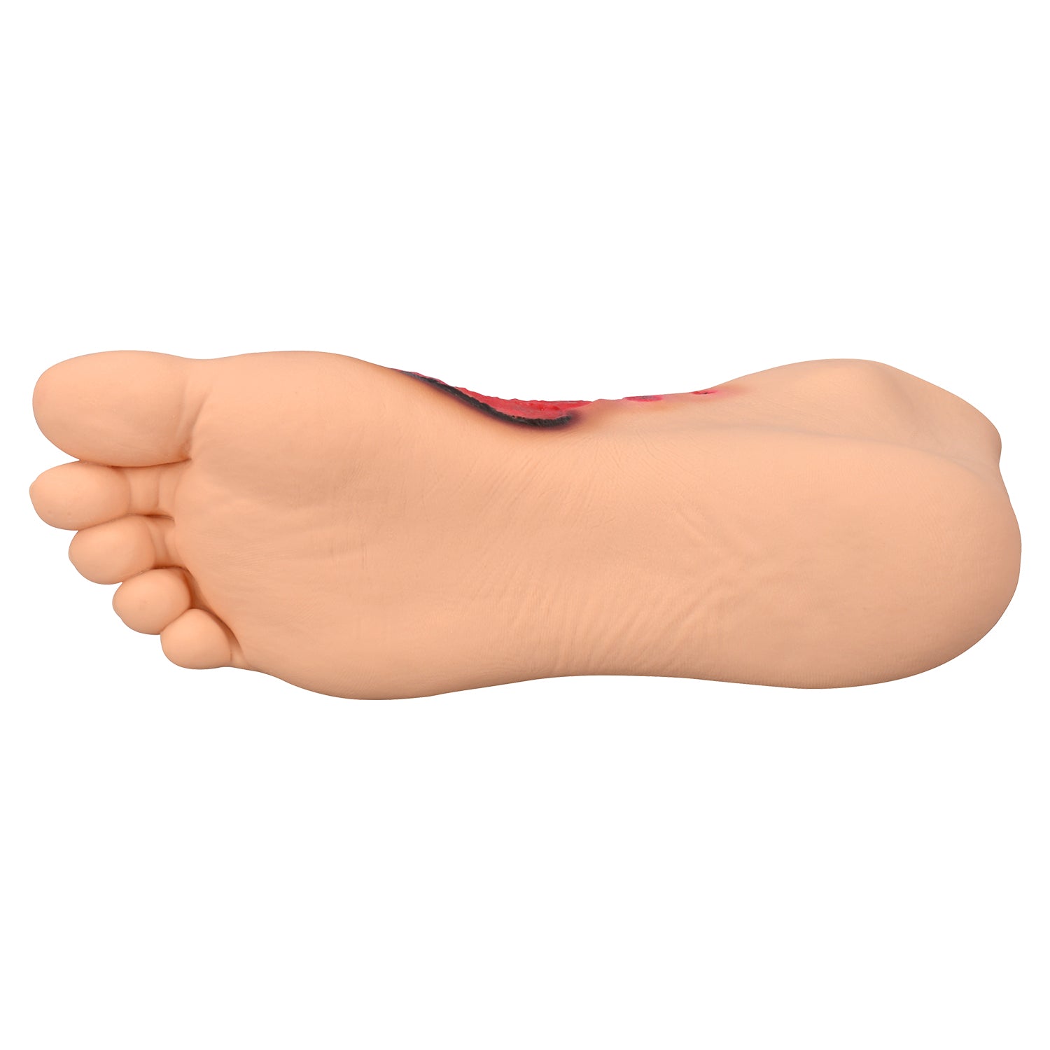 Chemical Burn Foot Injury Simulation Model
