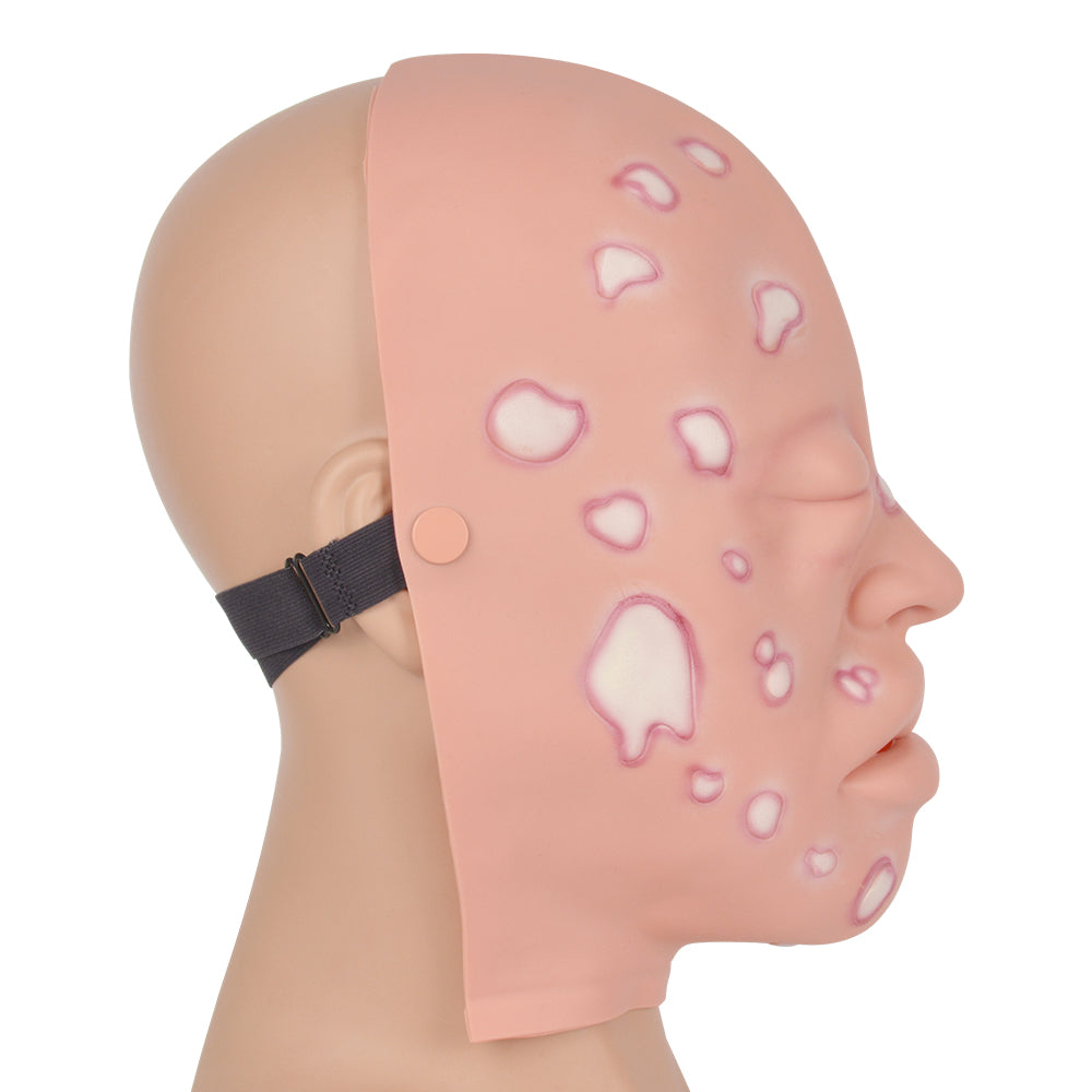 Chemical Burn Wound Assessment Training Model