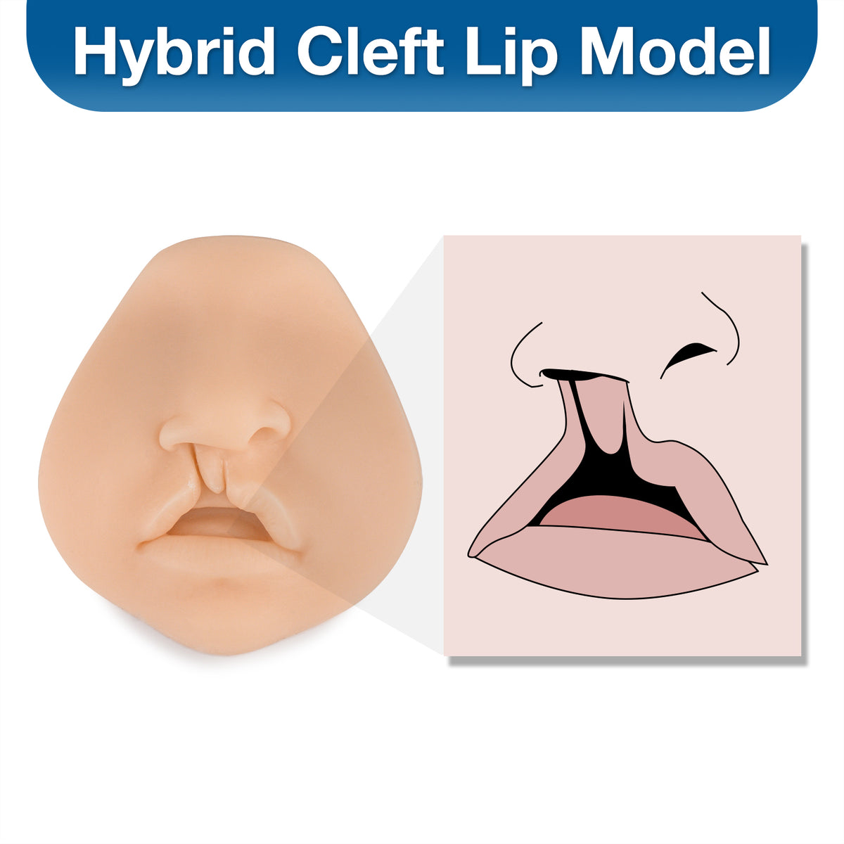 Cleft Lip Suturing Model & Repair Training Simulator