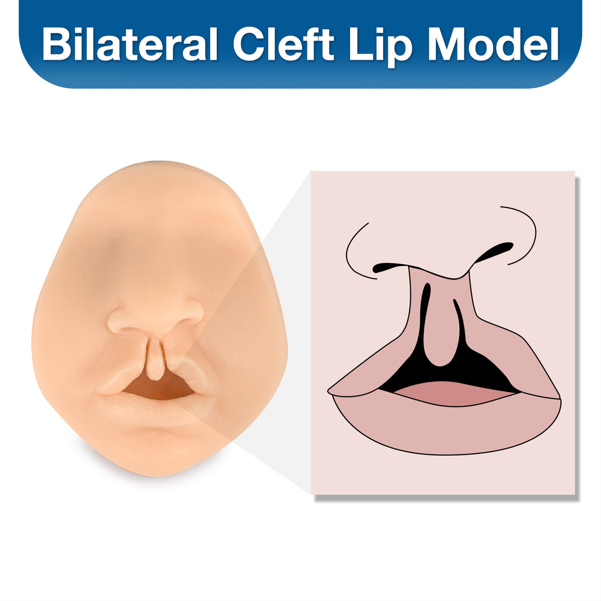 Cleft Lip Suturing Model & Repair Training Simulator