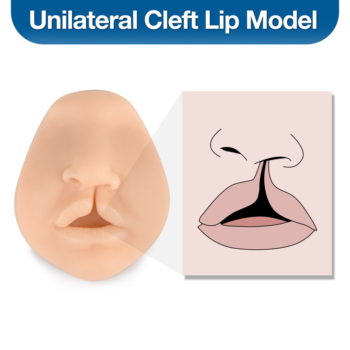 Cleft Lip Suturing Model & Repair Training Simulator