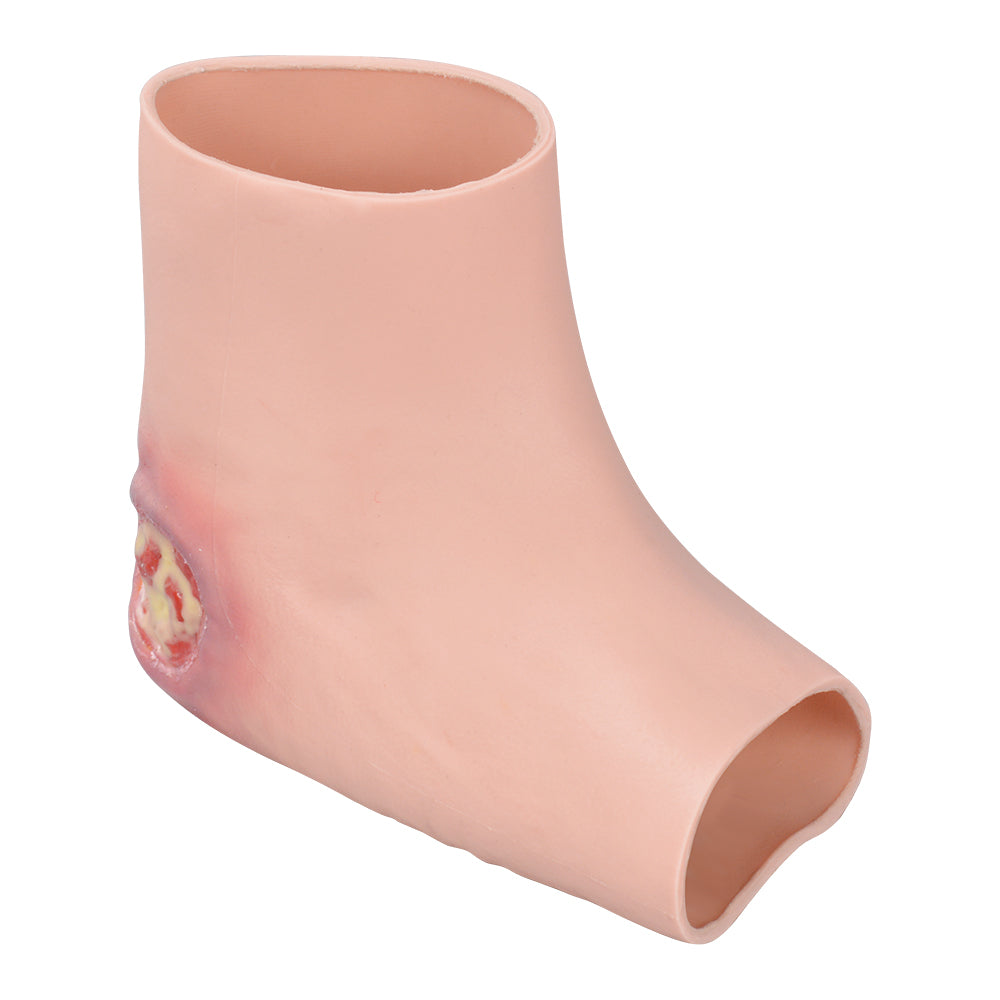 Clinical Wound Packing Heel Training Model