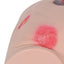 Close-Up Of Silicone Pressure Ulcer Details