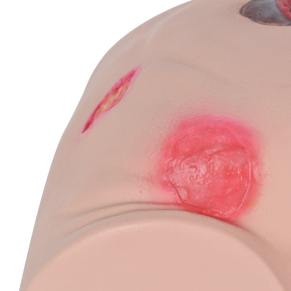 Close-Up Of Silicone Pressure Ulcer Details