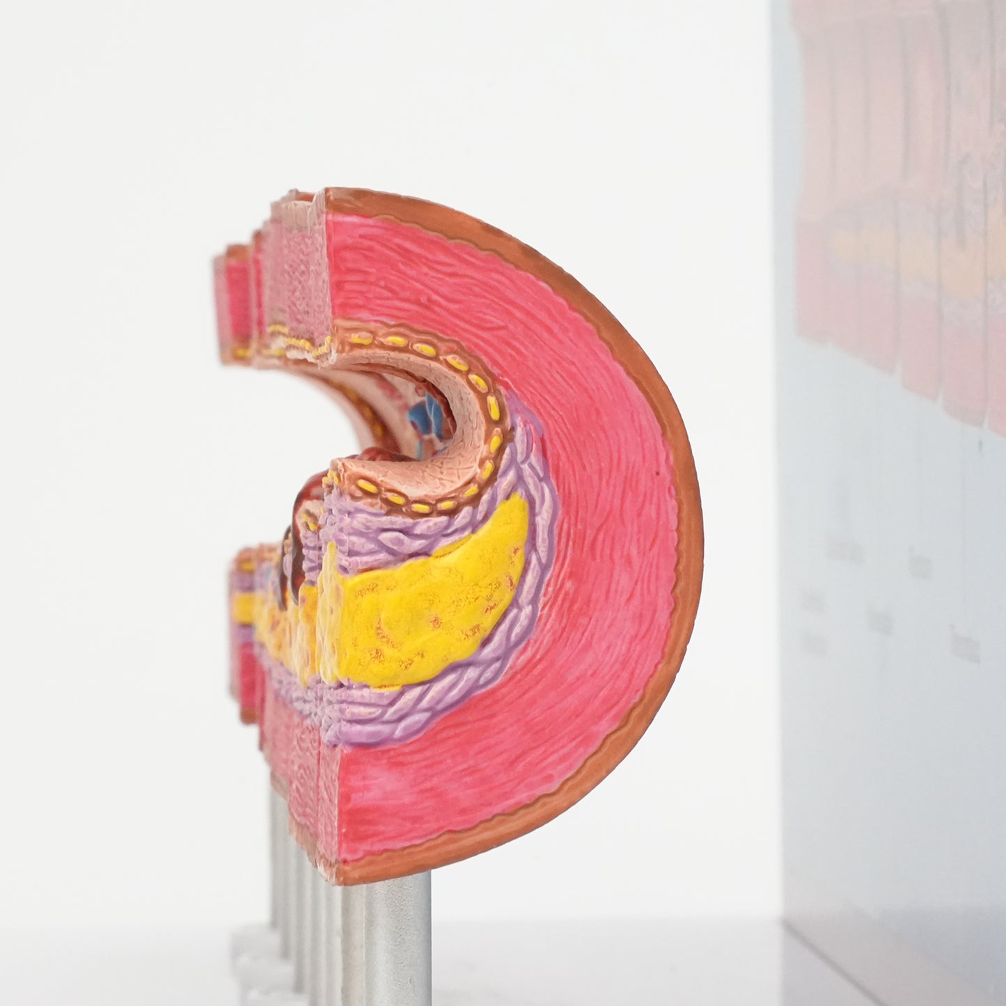 Close-Up Showing Detailed Pathological Features of Artery Model