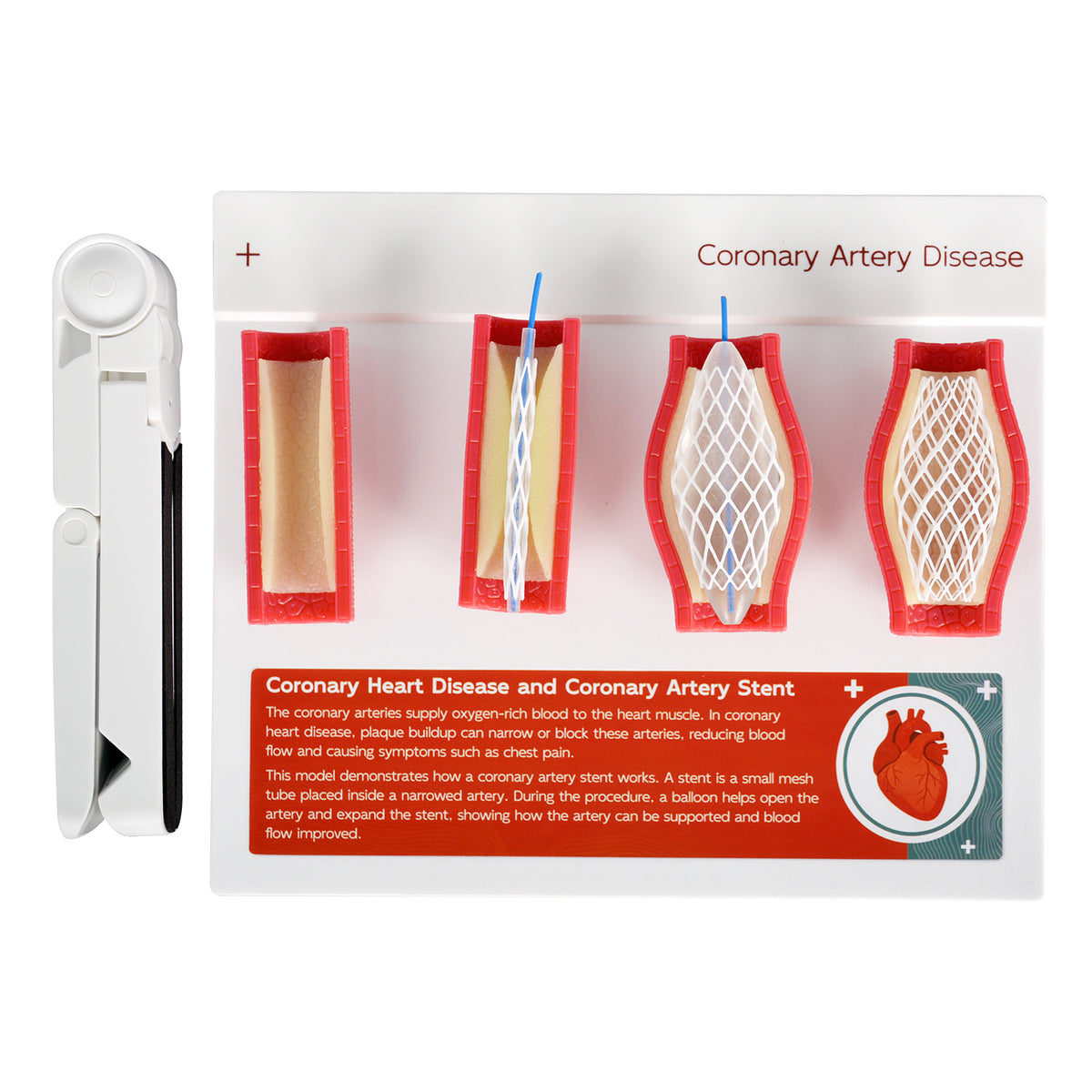 Coronary Artery Disease Model with Angioplasty and Stent