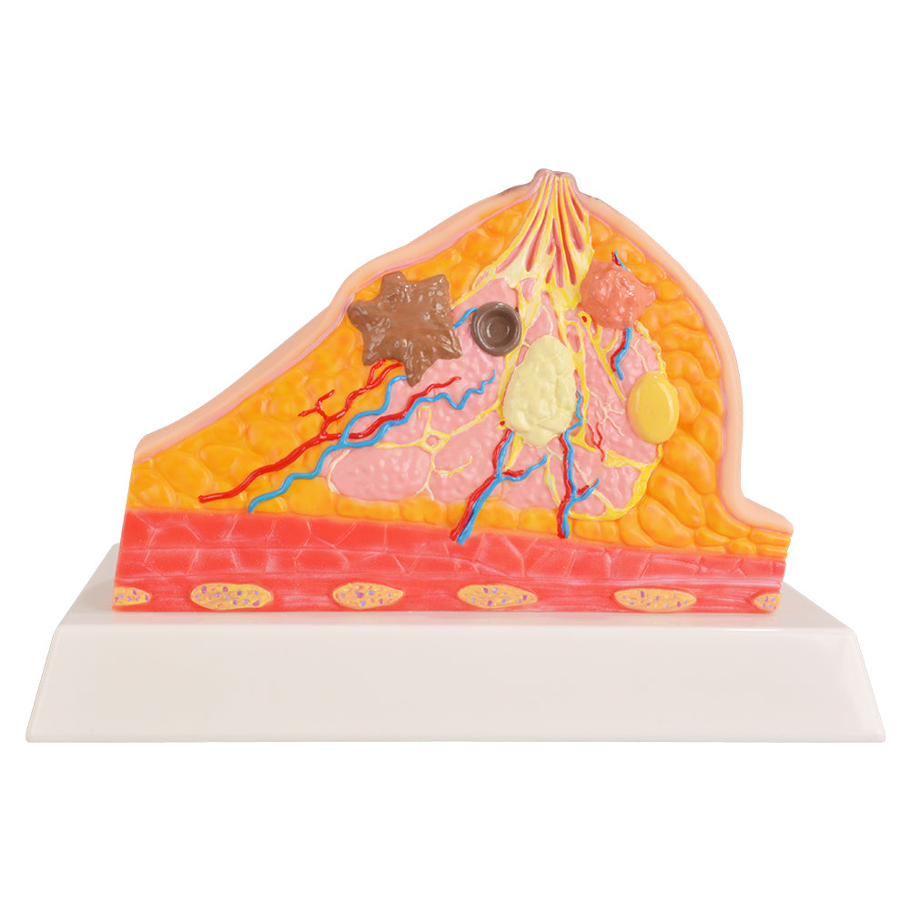 Cross Section Lab Model Cross Section Breast Anatomy Model with Pathological Features ...