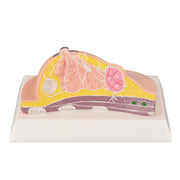 Cross Sectional Breast Anatomy Model with Common Diseases