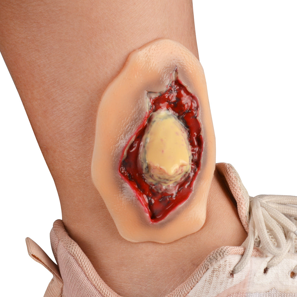 Wound Moulage – Ankle Fracture Wound Simulation Model