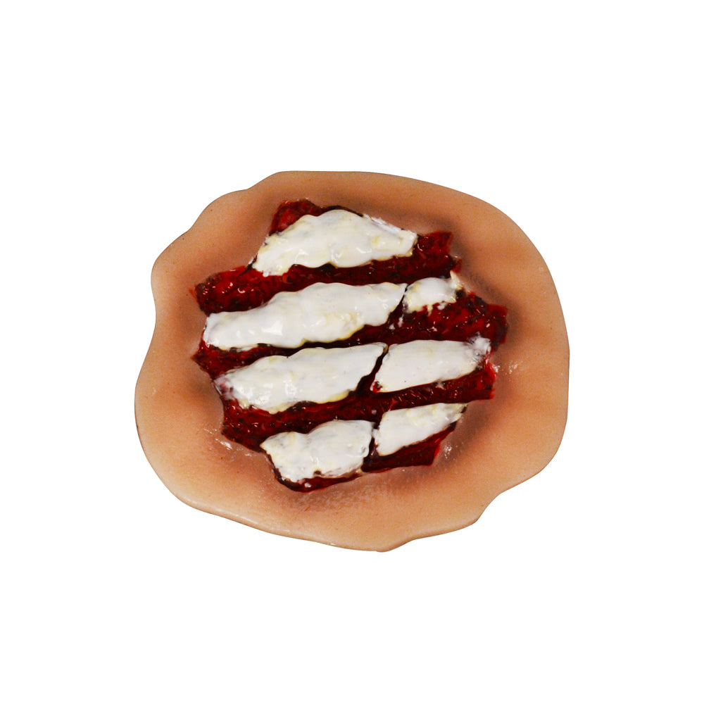 Wound Moulage - Dorsal Hand Laceration with Exposed Bone Simulation Model