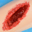 Deep Open Wound on the Thigh
