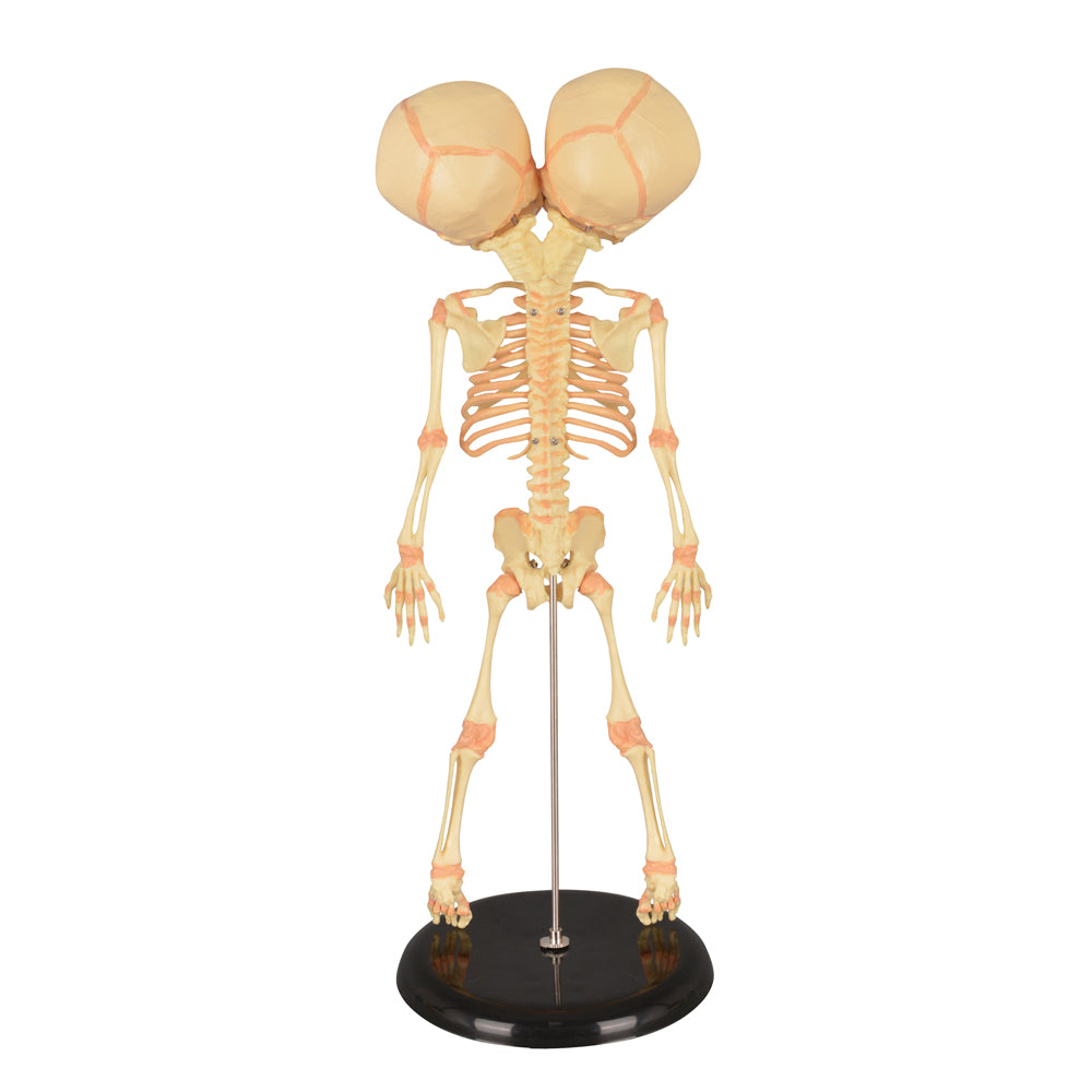 Detailed Baby Skeleton Model with Detachable Limbs