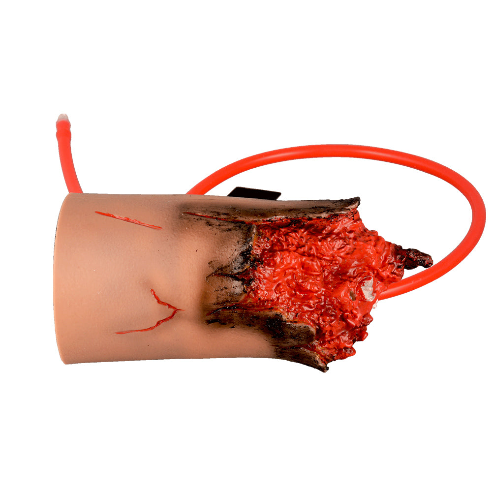 Detailed Traumatic Wound On Training Amputated Arm Model