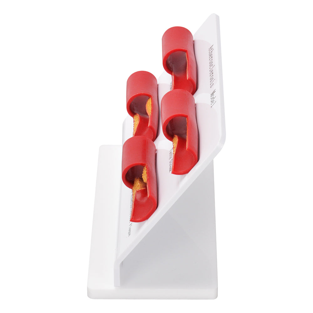 Detailed View Of Fibrous And Atherosclerotic Plaques