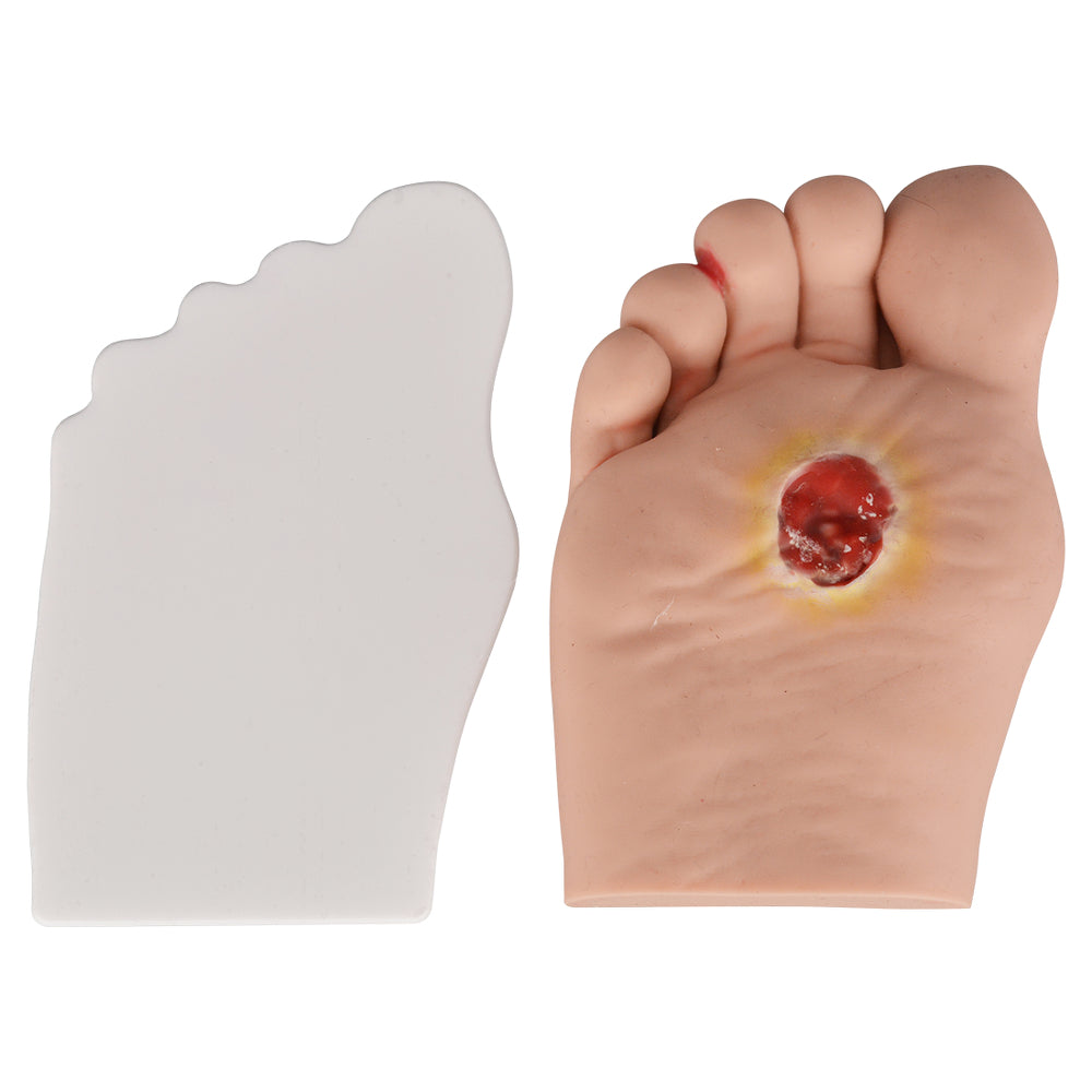 Diabetic Foot Infection Model