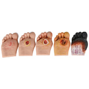 Diabetic Foot Models