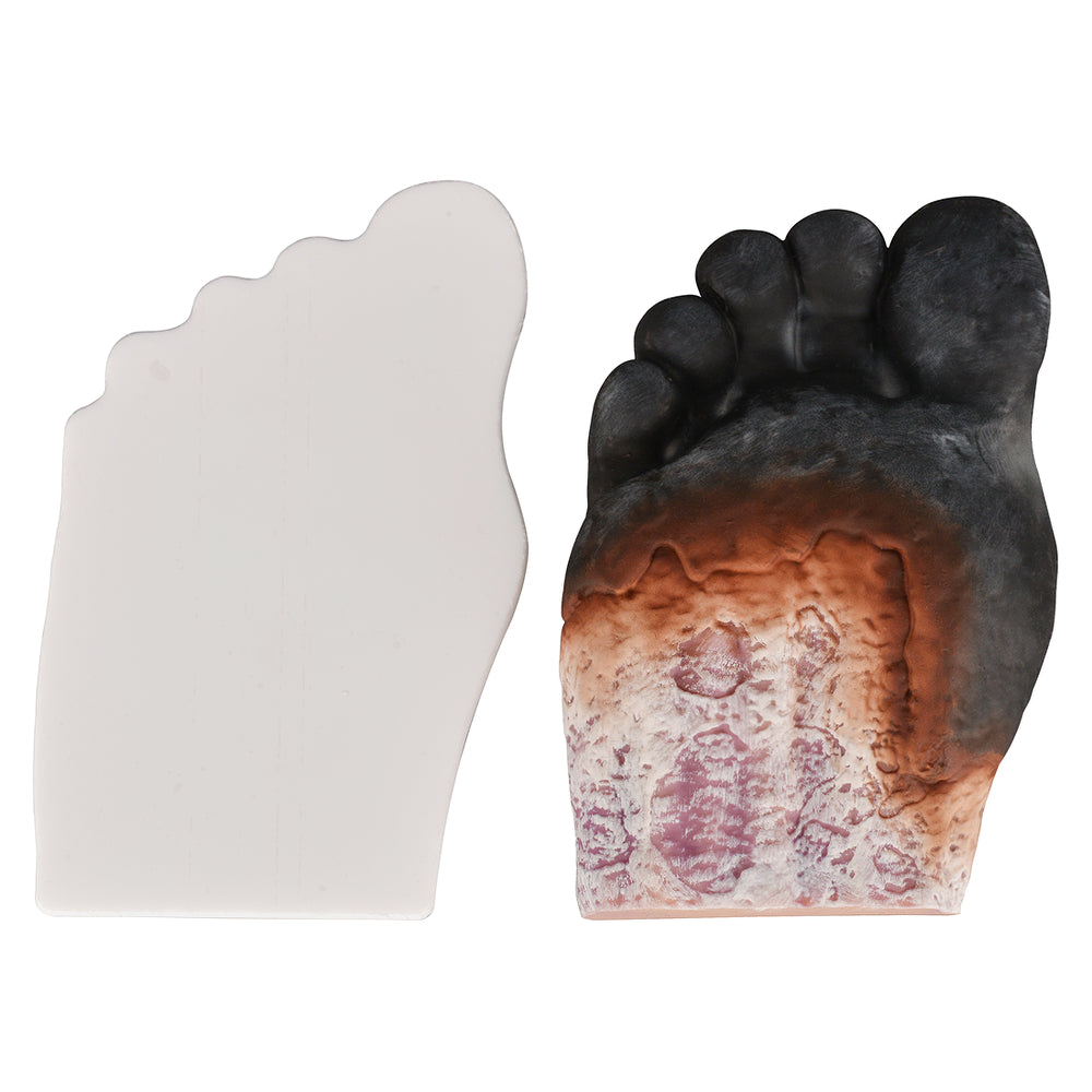Diabetic Foot Wound Dressing Model