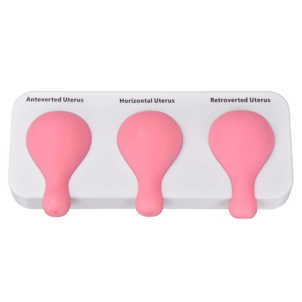 Dilatation and Curettage (D&C) Uterus Model