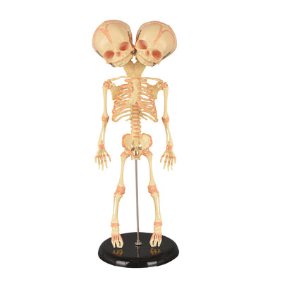 Double-Headed Infant Skeleton Model for Anatomy Teaching