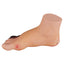 Educational Severe Diabetic Foot Model With Base