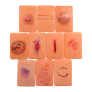 Elder Abuse Injury Demonstration Model Kit(Set of 10)