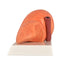 Fatty Liver Human Anatomy Model