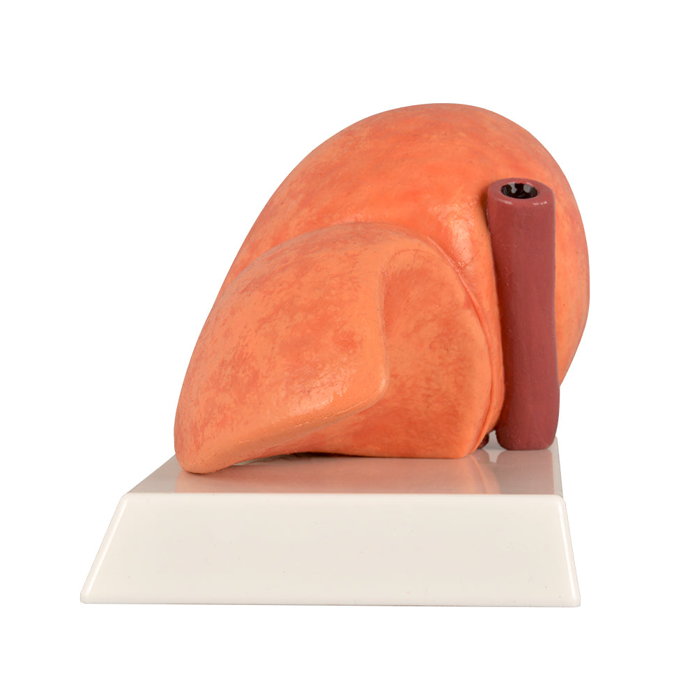 Fatty Liver Human Anatomy Model
